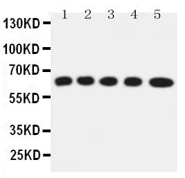 Anti-Solute carrier family 22 member 5/SLC22A5 Antibody Picoband® Boster Bio
