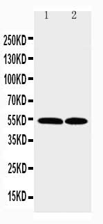 Anti-CCR3 Antibody Picoband® Boster Bio