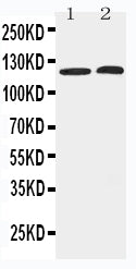 Anti-Histone deacetylase 5 HDAC5 Antibody Picoband® Boster Bio