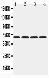 Anti-Hyaluronidase-1 HYAL1 Antibody Picoband® Boster Bio
