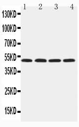 Anti-Hyaluronidase-1 HYAL1 Antibody Picoband® Boster Bio