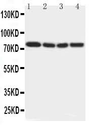 Anti-IRAK/IRAK1 Antibody Picoband® Boster Bio