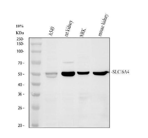 Anti-Monocarboxylate transporter 5 SLC16A4 Antibody Picoband® Boster Bio