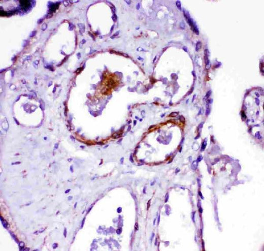 Anti-Angiotensin Converting Enzyme 1/ACE Antibody Picoband® Boster Bio