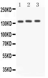 Anti-Angiotensin Converting Enzyme 1/ACE Antibody Picoband® Boster Bio