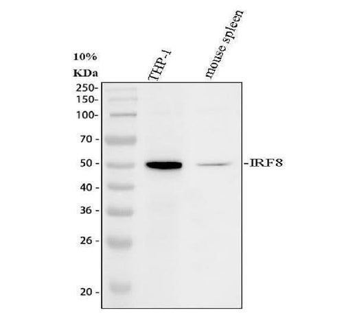 Anti-Interferon regulatory factor 8 IRF8 Antibody Picoband® Boster Bio