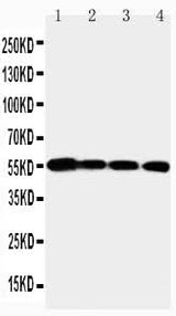 Anti-Matrix metalloproteinase-24 MMP24 Antibody Picoband® Boster Bio