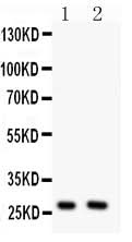 Anti-Olig1 Antibody Picoband® Boster Bio