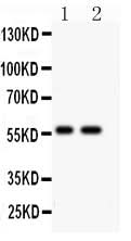 Anti-E3 SUMO-protein ligase PIAS4 Antibody Picoband® Boster Bio