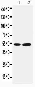 Anti-SBP/SELENBP1 Antibody Picoband® Boster Bio