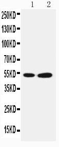 Anti-SBP/SELENBP1 Antibody Picoband® Boster Bio
