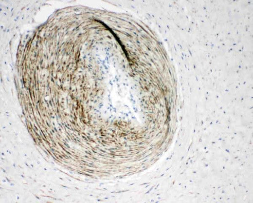 Anti-Calponin/CNN1 Antibody Picoband® Boster Bio