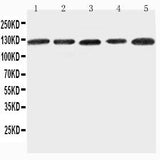 Anti-Integrin alpha-7 ITGA7 Antibody Picoband® Boster Bio