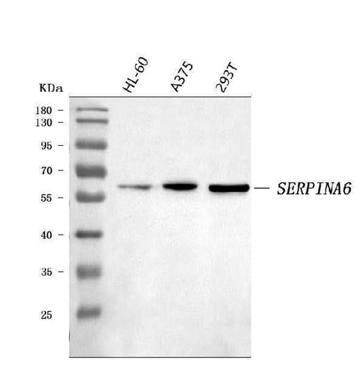 Anti-Cortisol Binding Globulin/SERPINA6 Antibody Picoband® Boster Bio