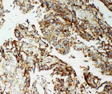 Anti-AIF/AIFM1 Antibody Picoband® Boster Bio