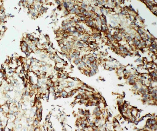 Anti-AIF/AIFM1 Antibody Picoband® Boster Bio