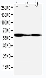 Anti-G-protein coupled receptor 30/GPER1 Antibody Picoband® Boster Bio