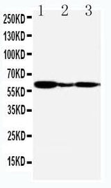 Anti-G-protein coupled receptor 30/GPER1 Antibody Picoband® Boster Bio