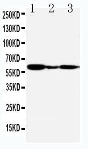 Anti-G-protein coupled receptor 30/GPER1 Antibody Picoband® Boster Bio