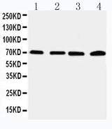 Anti-IRAK2 Antibody Picoband® Boster Bio