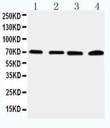 Anti-IRAK2 Antibody Picoband® Boster Bio