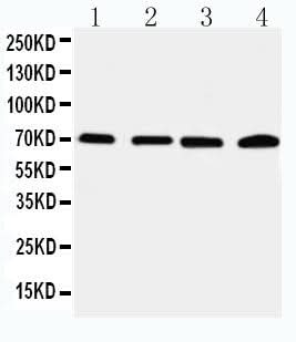 Anti-IRAK2 Antibody Picoband® Boster Bio