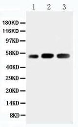 Anti-DNA/RNA-binding protein KIN17 KIN Antibody Picoband® Boster Bio