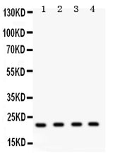 Anti-Securin/PTTG1 Antibody Picoband® Boster Bio