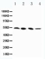 Anti-RIP3/RIPK3 Antibody Picoband® Boster Bio