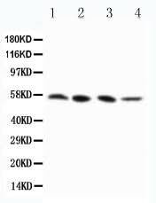 Anti-RIP3/RIPK3 Antibody Picoband® Boster Bio