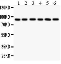 Anti-Toll-like receptor 1 TLR1 Antibody Picoband® Boster Bio