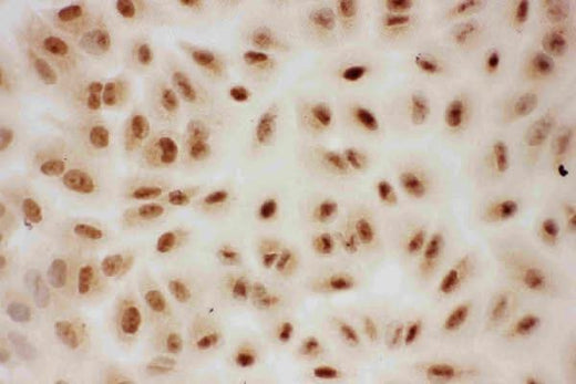 Anti-E3 SUMO-protein ligase PIAS1 PIAS1 Antibody Picoband® Boster Bio
