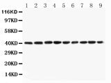 Anti-PON1 Antibody Picoband® Boster Bio