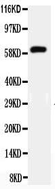 Anti-HNF1 beta/HNF1B Antibody Picoband® Boster Bio