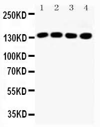 Anti-Insulin receptor substrate 1 IRS1 Antibody Picoband® Boster Bio