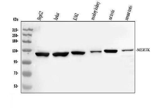 Anti-Tyrosine-protein kinase Mer MERTK Antibody Picoband® Boster Bio