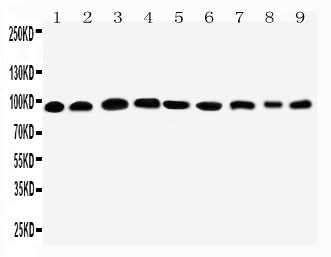Anti-Plakophilin 2/PKP2 Antibody Picoband® Boster Bio