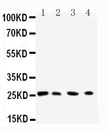 Anti-Ras-related protein Rab-3C Rab3C Antibody Picoband® Boster Bio