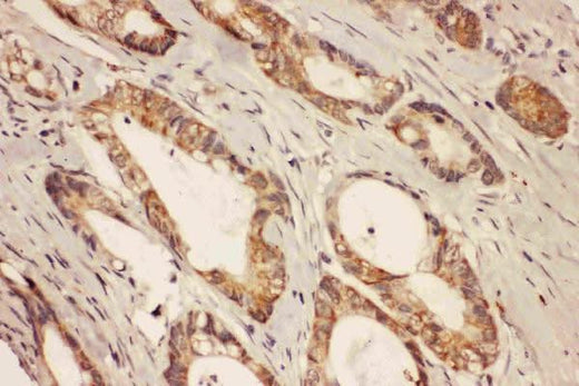 Anti-Ras-related protein Rab-8A RAB8A Antibody Picoband® Boster Bio