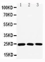 Anti-Ras-related protein Rab-11A Rab11A Antibody Picoband® Boster Bio