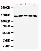 Anti-ST5 Antibody Picoband® Boster Bio