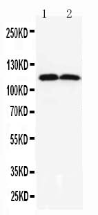 Anti-TMEM16A/ANO1 Antibody Picoband® Boster Bio