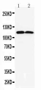 Anti-TMEM16A/ANO1 Antibody Picoband® Boster Bio