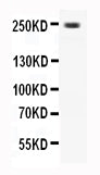 Anti-CaV1.3/CACNA1D Antibody Picoband® Boster Bio