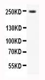 Anti-CaV1.3/CACNA1D Antibody Picoband® Boster Bio