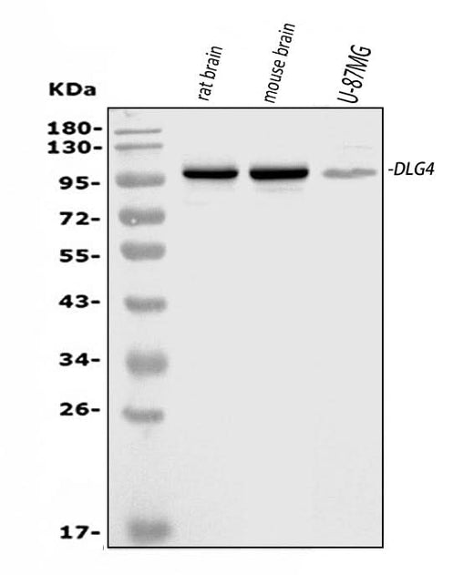 Anti-PSD95/DLG4 Antibody Picoband® Boster Bio