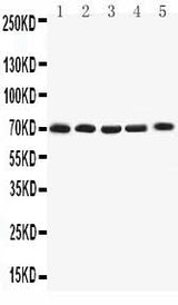Anti-Kv1.4/KCNA4 Antibody Picoband® Boster Bio