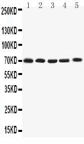 Anti-Kv1.4/KCNA4 Antibody Picoband® Boster Bio