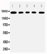 Anti-Mucin-1 MUC1 Antibody Picoband® Boster Bio