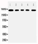 Anti-Mucin-1 MUC1 Antibody Picoband® Boster Bio